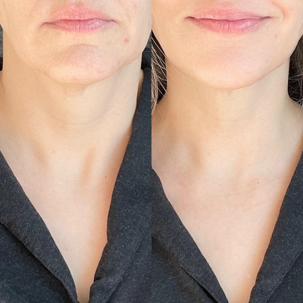 Sculpt Arm Cream